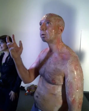 Colin Morgan characterized with burnt skin prosthetics for dramatic role - Special effects detail. This was an experimental project where his character hatched out of an egg.
